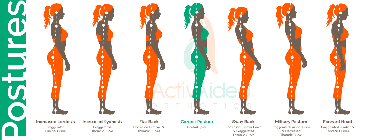 4 Types of Poor Posture and How to Fix Each of Them / Bright Side