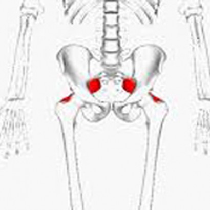 piriformis syndrome